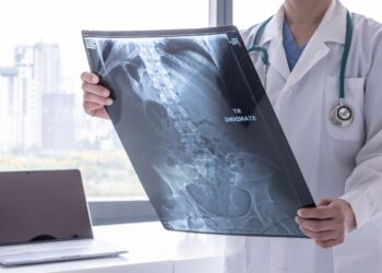“Kanser önlenebilir bir hastalıktır”
