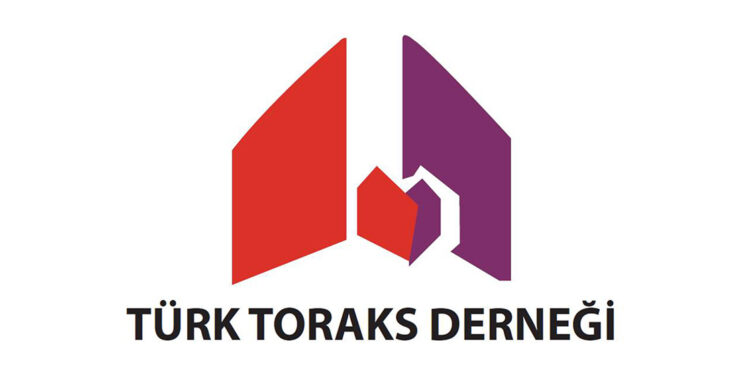 Sahra Çölü’nden Türkiye ve Avrupa’ya doğru çöl tozu hareketi!