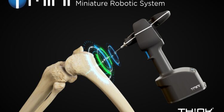THINK Surgical Receives FDA 510(k) Clearance for TMINI Miniature Robotic System (TMINI 1.1)  