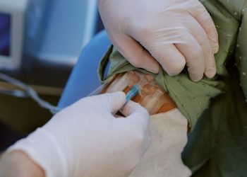 MS’de kök hücre umudu